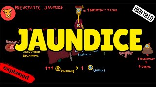 JAUNDICE Classification Pathogenesis Types of Jaundice Why urine is yellow [upl. by Ellenor]