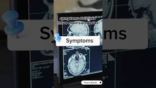 What is Schizophrenia  schizophrenia symptoms causes and Treatment schizophrenia neuroscience [upl. by Waligore541]