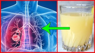 For Smokers and Ex Smokers Lung Detox in Just 2 Hours  Clean Your Lungs Naturally [upl. by Eimaraj]