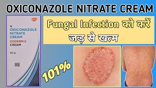 ZODERM E CREAM  Oxiconazole Nitrate cream uses dose side effect  Zoderm E cream review in hindi [upl. by Rosenblum406]