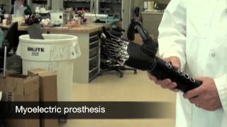 Prosthetist Career Spotlight [upl. by Redd]