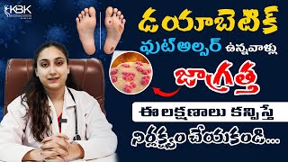 Diabetic Foot Ulcer Expert Reveals Shocking Truth About Symptoms  KBK Hospitals [upl. by Gudrun]