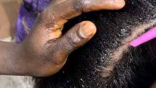 Asmr greasing scalp Plaiting hair not planned [upl. by Fey]