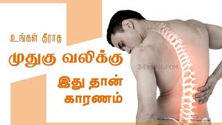 Causes of Lower Back Pain  Reasons medication treatment and home remedies  Tamil Health Tips [upl. by Ahsauqal]