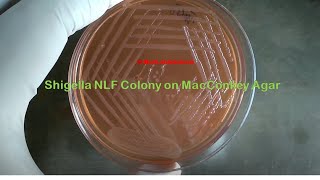 Nonlactose fermenter colony of Shigella [upl. by Iren130]