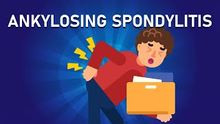 What is Ankylosing Spondylitis  Arthritis That Fuses Your Bones [upl. by Dowell736]