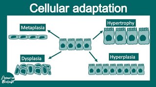 metaplasiahyperplasiahypertrophy and atrophy [upl. by Orpheus16]