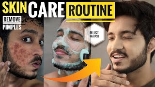 EASY amp BEST Skin Care Routine For BOYS amp MEN  Remove Acne Pimples amp Darkspots FAST 🔥🔥 [upl. by Kiker]