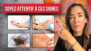 Ces 9 Signes Alarmants Révèlent Que Vous Manquez CRUELLEMENT de Protéines  ⚠️❗ [upl. by Sldney943]