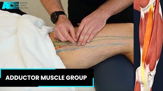 Dry Needling Adductor Muscle group [upl. by Otreblada687]