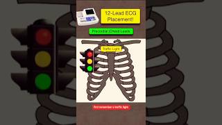 12 Lead ECG placement ECG leads kaise lagay ecg biology shorts youtubeshorts youtube [upl. by Enelloc5]