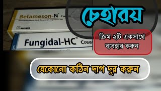 Betameson N Cream amp Fungidal HC Cream ক্রিম দুটি চেহারা পরিষ্কার করার জন্য জাদুর মত কাজ করে [upl. by Latoniah814]