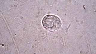 Trichomonas vaginalis  sexually transmitted parasite [upl. by Gnuhc]