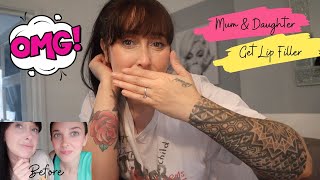 LIP FILLER VLOG  MUM amp DAUGHTER GET LIP FILLER TOGETHER  BEFORE amp AFTER [upl. by Lucio]