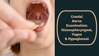 Cranial Nerve Examination CN 9 10 amp 12 glossopharyngeal vagus amp hypoglossal [upl. by Pardew132]