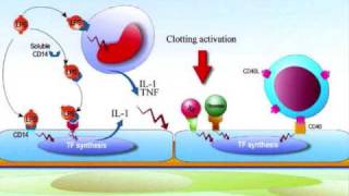 Pathology Hemostasis Lecture [upl. by Lekim]