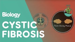 What Is Cystic Fibrosis  Health  Biology  FuseSchool [upl. by Melli]