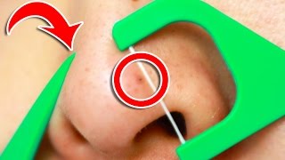 6 Clever Tricks To Unclog Pores INSTANTLY [upl. by Tish]