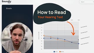 How to Read a Hearing Test  Common Configurations [upl. by Jowett]