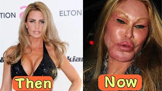 10 Hollywood Stars After Plastic Surgery 🖤 Then And Now [upl. by Moht]