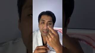 CONJUNTIVITIS TIPOS Y TRATAMIENTO DR VICTOR TORREALVA OFTALMÓLOGO [upl. by Nonek593]