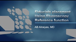 Fiducial Markers Placement Using REBUS and ION robotic bronchoscopy Fluoroscopy Reference Function [upl. by Odnalor545]