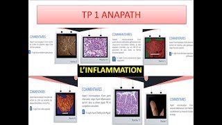 réussir son examen danapath tp n°1 linflammation [upl. by Reivaxe]