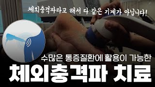 그냥 하라고 해서 하셨다고요 제대로 알고 치료받자 만능통증 치료기기 체외충격파 [upl. by Kassi226]