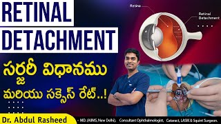 What is the best treatment for retinal detachment  Retinal detachment telugu  Dr Abdul Rasheed [upl. by Kele]