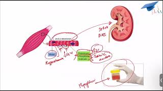 Rhabdomyolysis [upl. by Darrel254]