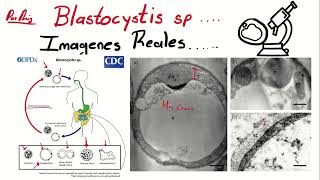 Blastocystis hominis al microscopio óptico [upl. by Eelyac]