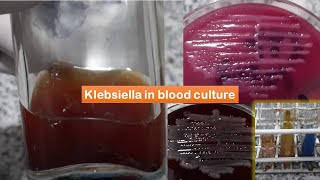 Klebsiella growth in BHI broth Macconkey and blood agar [upl. by Weinstein]