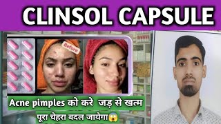 Clinsole Capsule acne पिंपल्स को ख़त्म करने की बेस्ट कैप्सूल जल्दी देखो सिर्फ 7 दिनों में 😱 acne [upl. by Ekle]