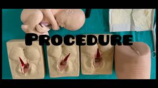 Episiotomy and PeriniotomyOBG [upl. by Norreht]