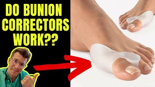 DO BUNION CORRECTORS WORK Doctor explains [upl. by Satterlee]