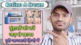 Retino A Cream use benefits and side effects full review in hindi [upl. by Bond311]