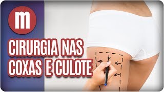 Cirurgia plástica nas coxas e culote  Mulheres 070717 [upl. by Elisabetta]