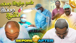 சம்பத்கான் கு முடி நட்டாச்சு  Hair Plantation  WFT Vlog [upl. by Janna305]