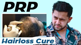 PRP Therapy  Before amp After Side Effects amp Benefits  PRP Cost In Bangladesh [upl. by Nazar117]