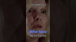 Celebrities who have mutations shorts celebfacts mutations [upl. by Nitsej]