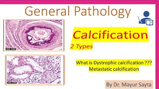 Pathological Calcification [upl. by Li]