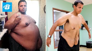 The Incredible Shrinking Man  Jesse Shand Lost 350 Pounds [upl. by Artcele]