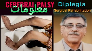 Spastic Cerbral Palsy Diplegia Detailed overview  Surgical and Rehabilitation Treatment Pathways [upl. by Ataymik]