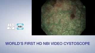 Olympus NBI Urology Video  English Version [upl. by Lessard]