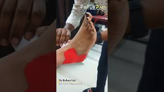 Ankle Sprain Taping  Ankle Stability  Sprained Ankle [upl. by Dennie]