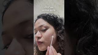 Overnight Acne Spot Corrector  How to Use [upl. by Marutani575]