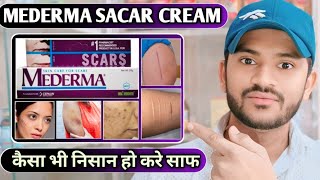 Medrma scar cream use dose benefits and side effects full review hindi [upl. by Ayekehs]