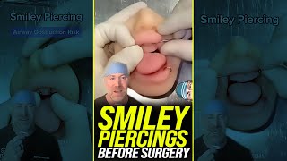 Smiley Piercings Before Surgery 😱 shorts [upl. by Devan]