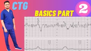 CTG Basics Part 2  CTG Monitoring in Pregnancy Fetal Cardiotocography [upl. by Singh]