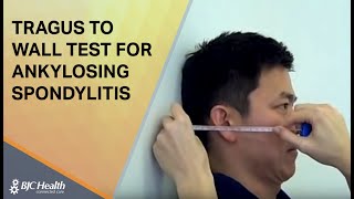 Tragus to Wall test for Ankylosing Spondylitis [upl. by Etteluap922]